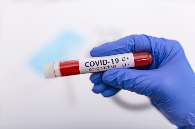 Aratiba está com 27 casos ativos de COVID 19.